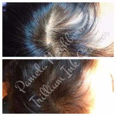 woman thinning hair before and after
